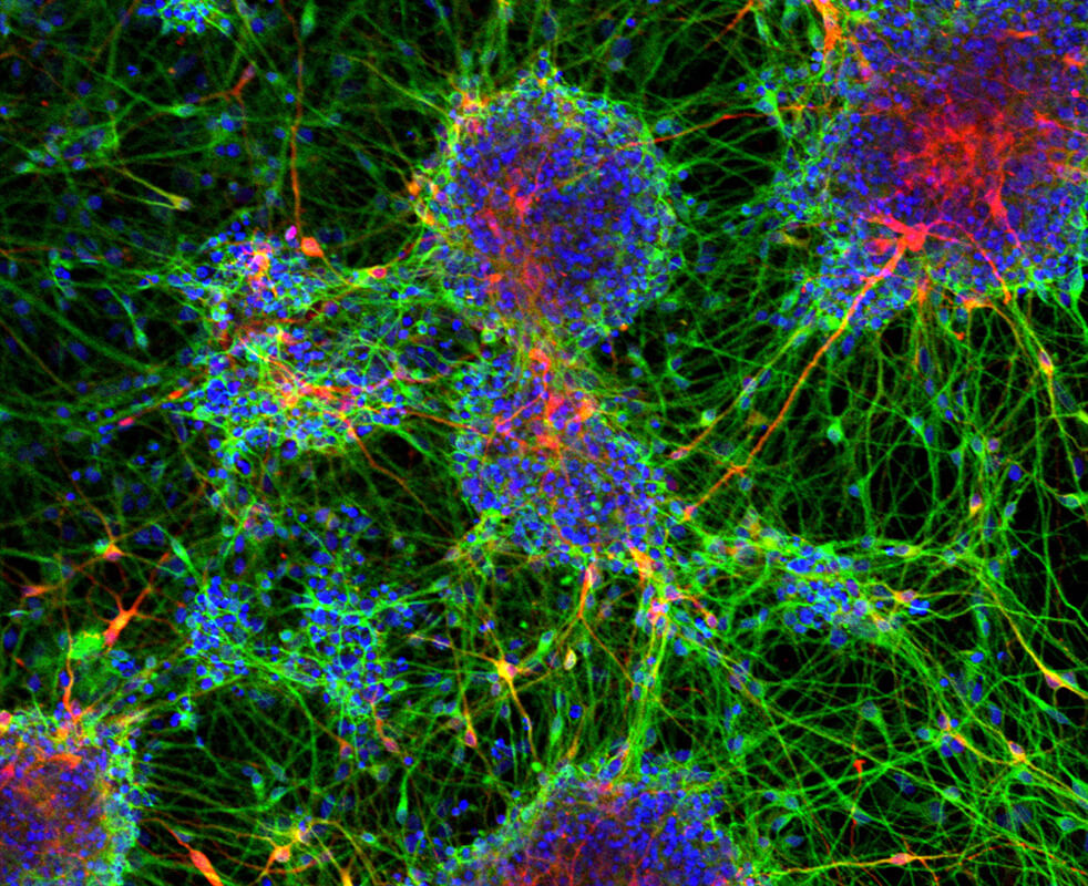 画像：顕微鏡を通して見える受精卵から分化した細胞の様子
